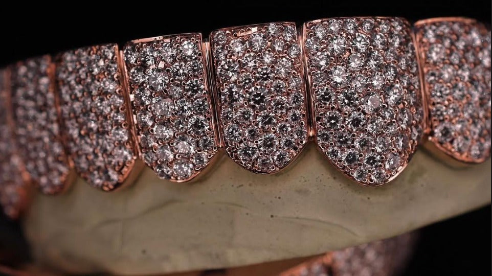 Mosaic Pave set VVS Moissanite Perm Cut Grillz 925 Sterling Silver, Pass Diamond Test