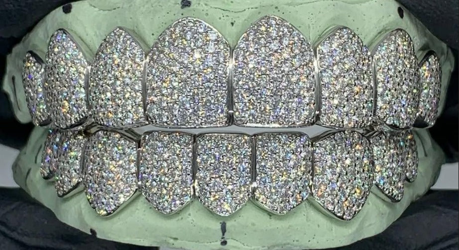 𝐕𝐕𝐒 𝐌𝐨𝐢𝐬𝐬𝐚𝐧𝐢𝐭𝐞 𝐆𝐫𝐢𝐥𝐥𝐳 𝐢𝐧 𝟗𝟐𝟓 𝐒𝐭𝐞𝐫𝐥𝐢𝐧𝐠 𝐒𝐢𝐥𝐯𝐞𝐫, 𝐃𝐢𝐚𝐦𝐨𝐧𝐝 𝐓𝐞𝐬𝐭𝐞𝐫 𝐀𝐩𝐩𝐫𝐨𝐯𝐞𝐝