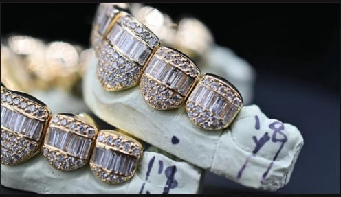 Custom Hybrid Grillz – VVS Moissanite Iced-Out Bust Down – Rhodium Plated Sterling Silver