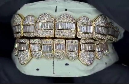 Custom Hybrid Grillz – VVS Moissanite Iced-Out Bust Down – Rhodium Plated Sterling Silver